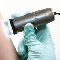 DinoLite Bőrgyógyászati mikroszkópok (DermaScope®)
